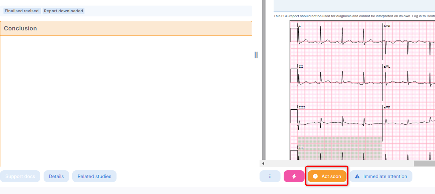 ECG-ACT SOON 2.png