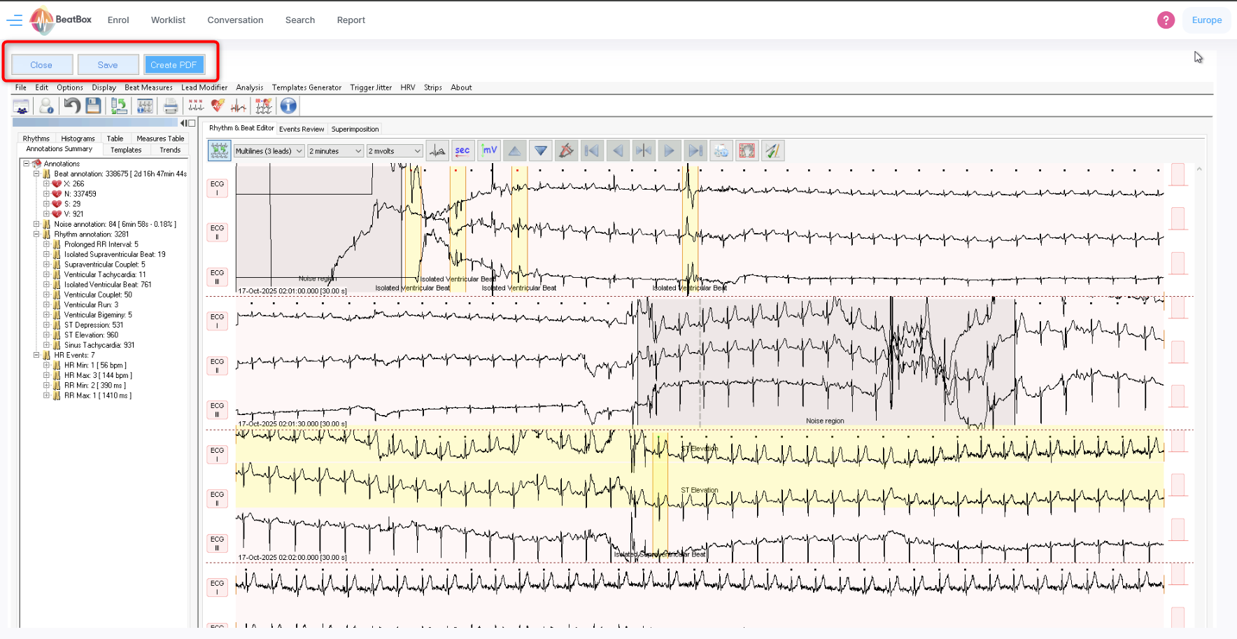 Analysis Tool - Save Create PDF Close.png